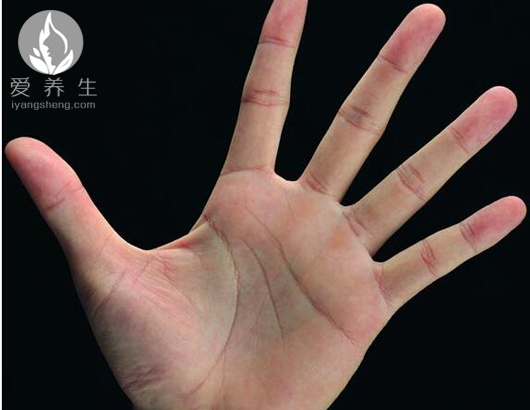 专家教你观手色看健康  很快就学会