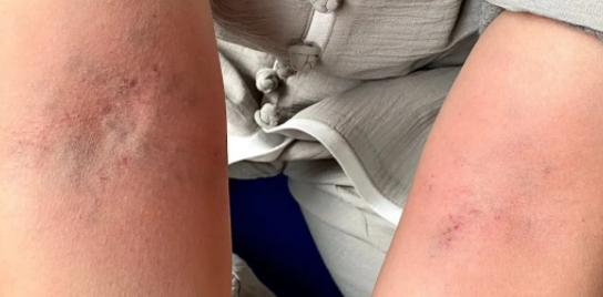 【辟谷日记】第五天：是放弃，还是坚持到底？这是个问题